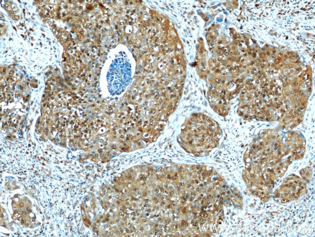 MCL1 Antibody in Immunohistochemistry (Paraffin) (IHC (P))