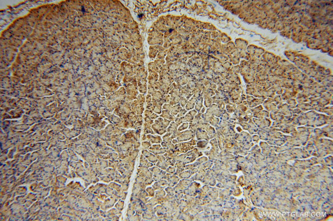 MCL1 Antibody in Immunohistochemistry (Paraffin) (IHC (P))