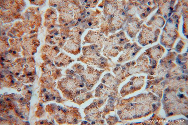 MCL1 Antibody in Immunohistochemistry (Paraffin) (IHC (P))