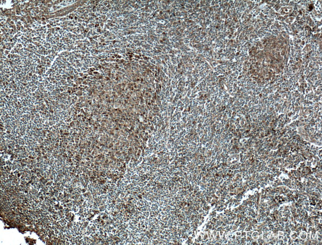 MCL1 Antibody in Immunohistochemistry (Paraffin) (IHC (P))