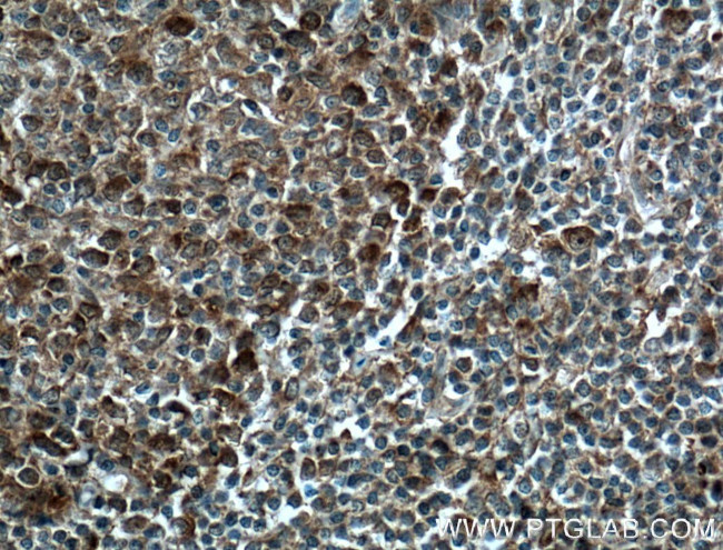 MCL1 Antibody in Immunohistochemistry (Paraffin) (IHC (P))