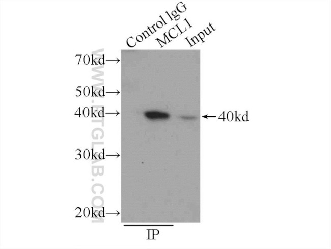 MCL1 Antibody in Immunoprecipitation (IP)