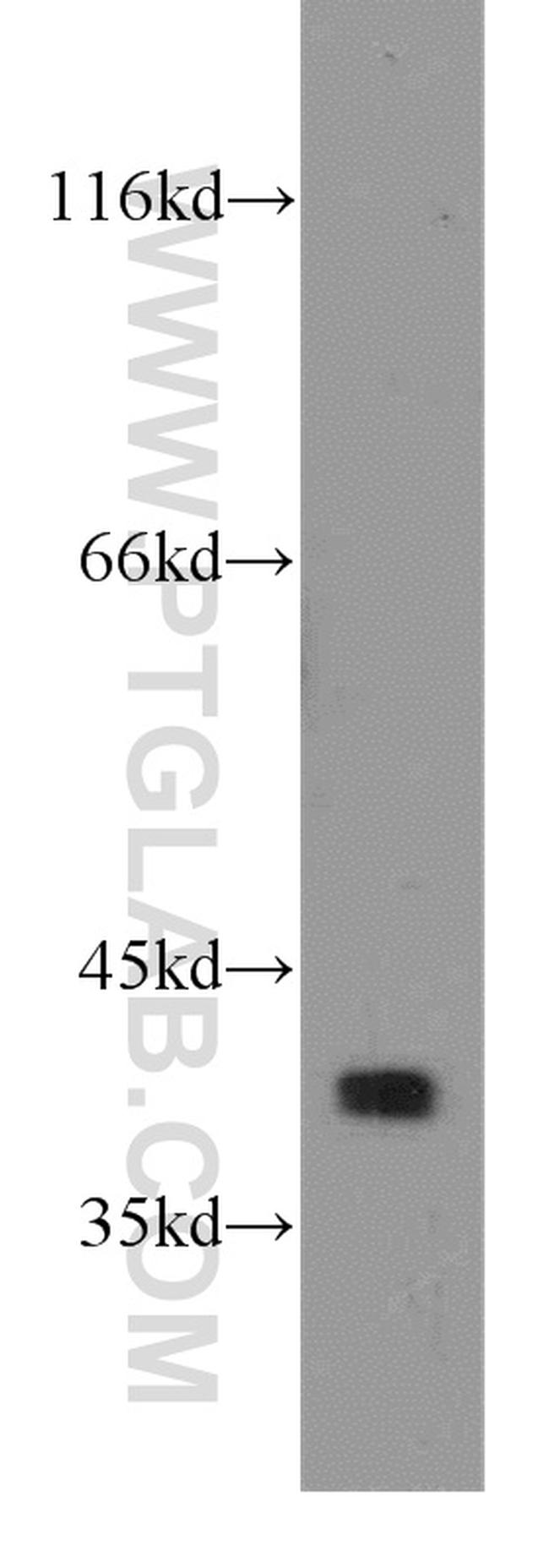 MCL1 Antibody in Western Blot (WB)