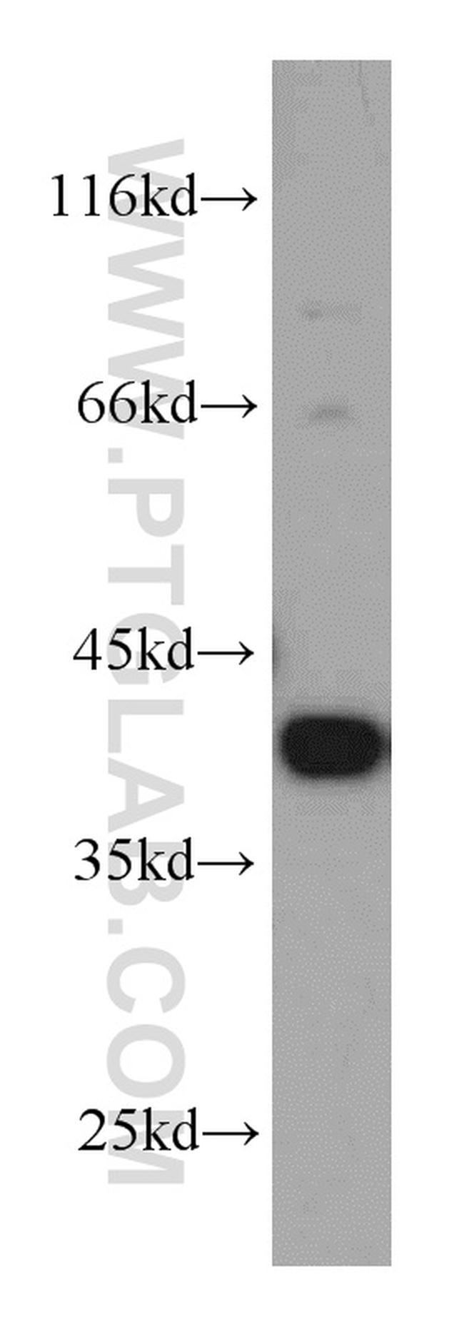 MCL1 Antibody in Western Blot (WB)