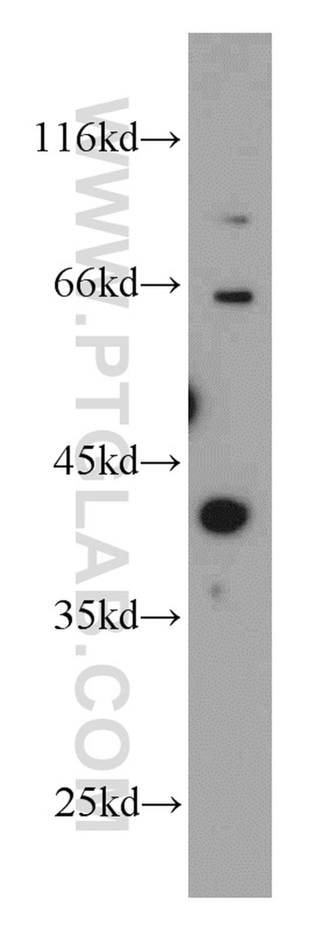 MCL1 Antibody in Western Blot (WB)