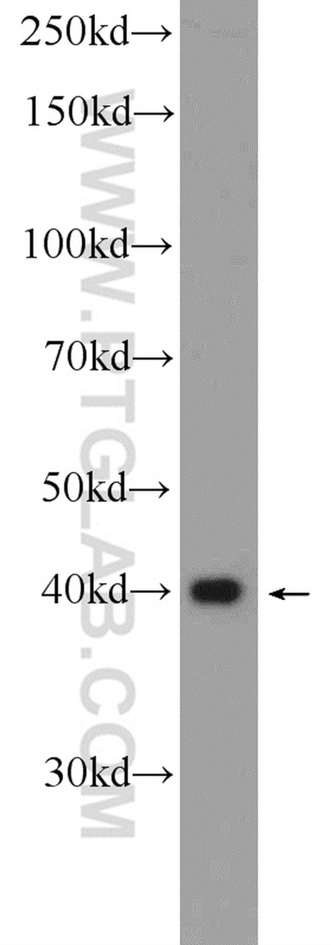 MCL1 Antibody in Western Blot (WB)