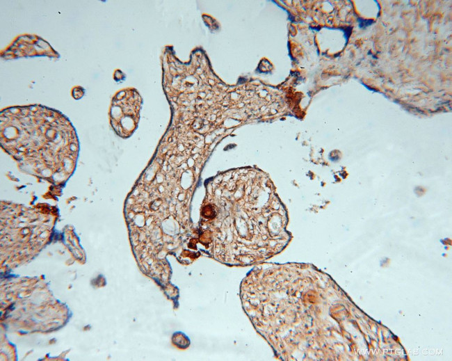 PDE4A Antibody in Immunohistochemistry (Paraffin) (IHC (P))