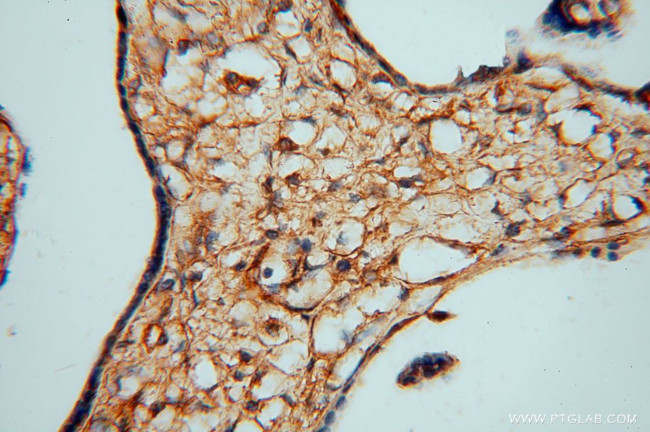 PDE4A Antibody in Immunohistochemistry (Paraffin) (IHC (P))