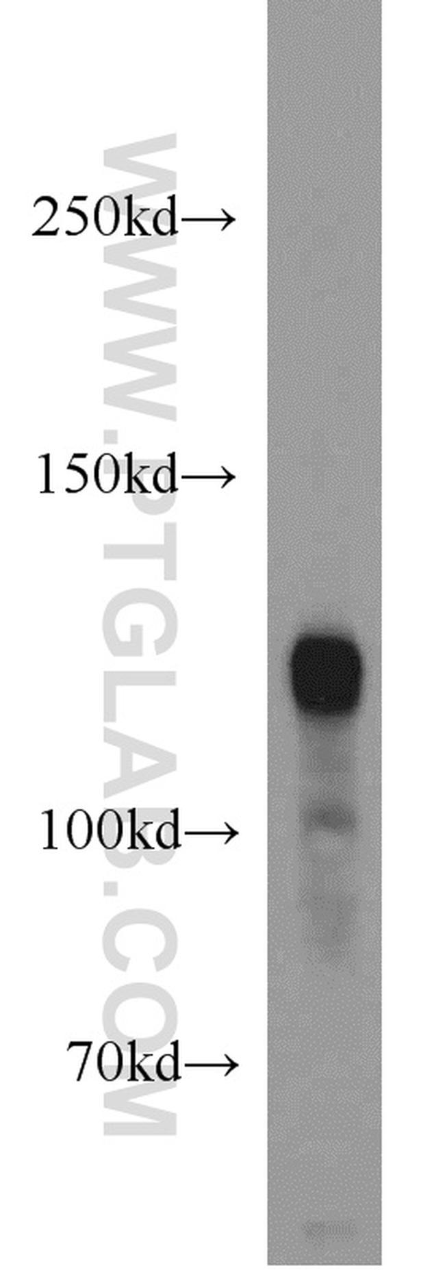 PDE4A Antibody in Western Blot (WB)