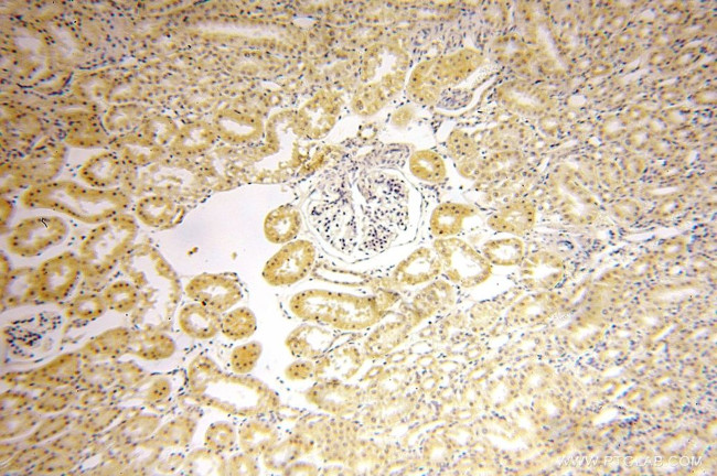 HEXB Antibody in Immunohistochemistry (Paraffin) (IHC (P))