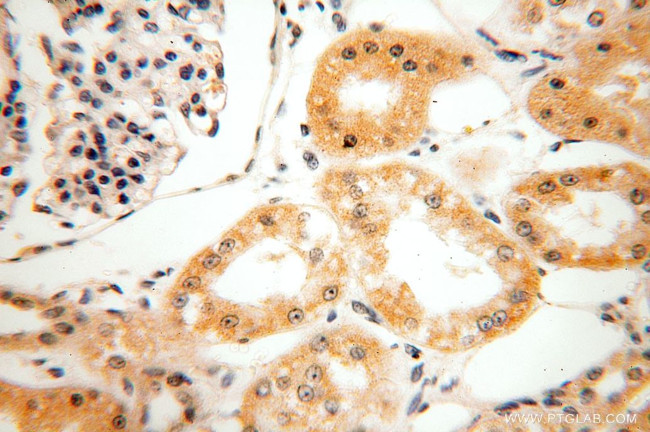 HEXB Antibody in Immunohistochemistry (Paraffin) (IHC (P))