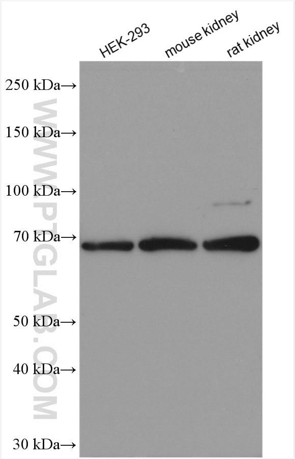 HEXB Antibody in Western Blot (WB)