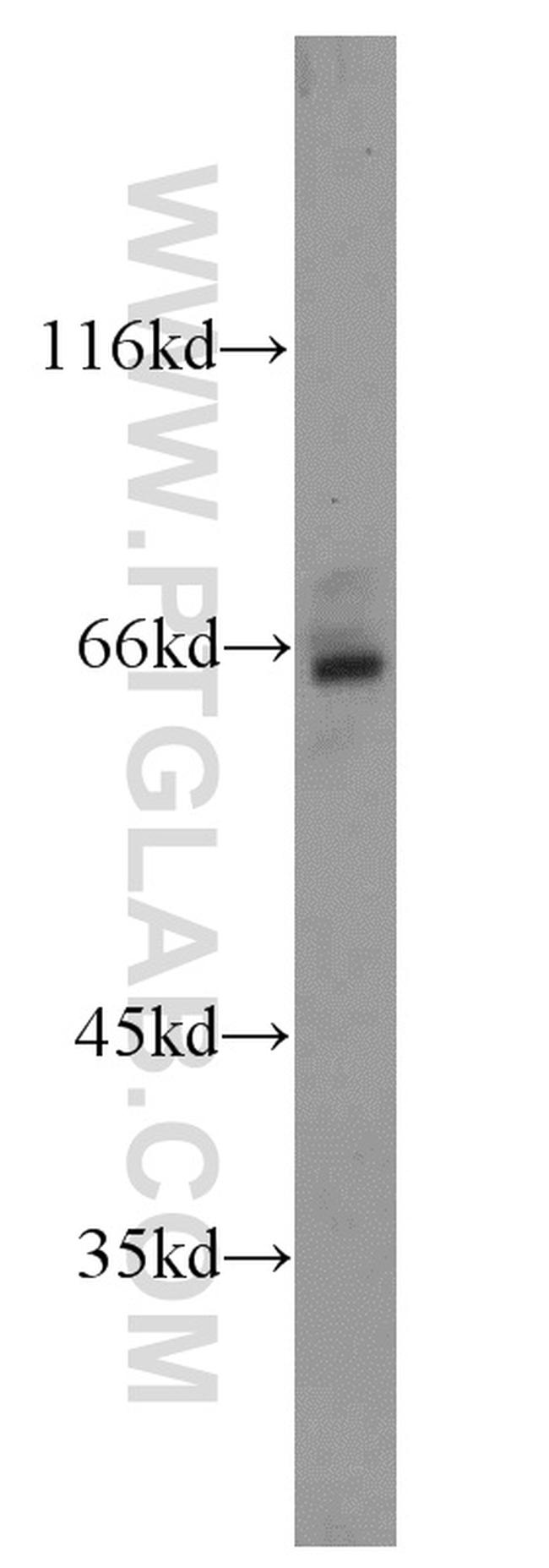 HEXB Antibody in Western Blot (WB)