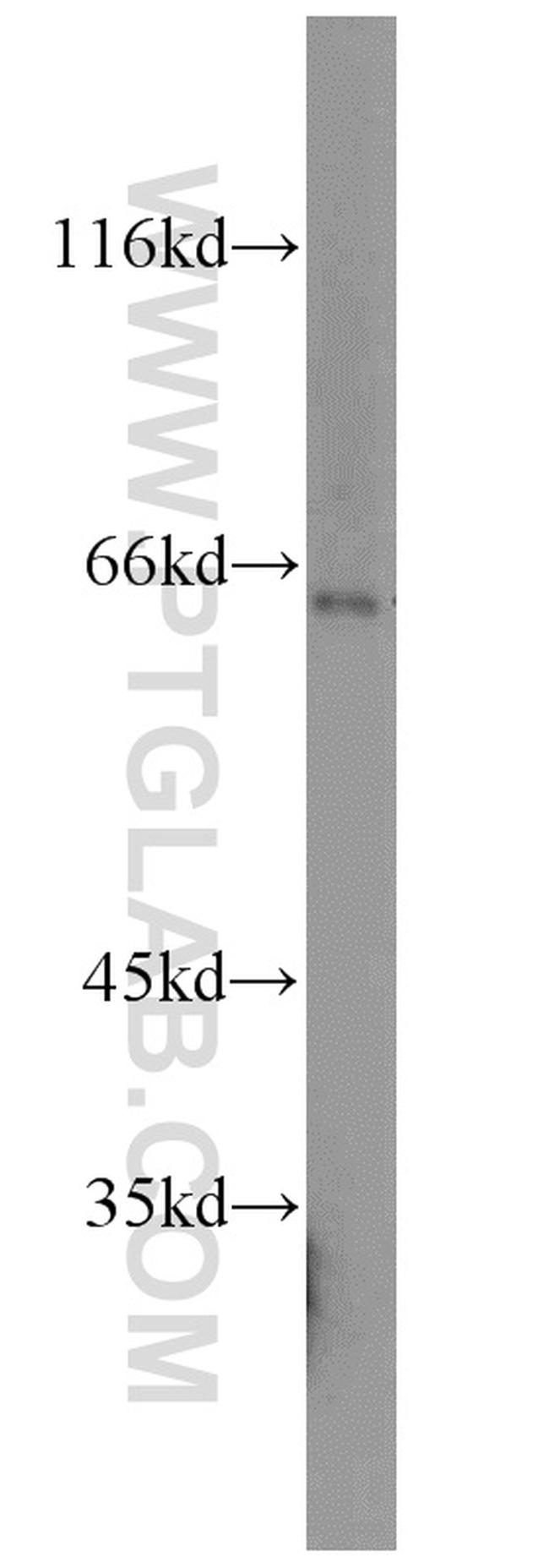 HEXB Antibody in Western Blot (WB)