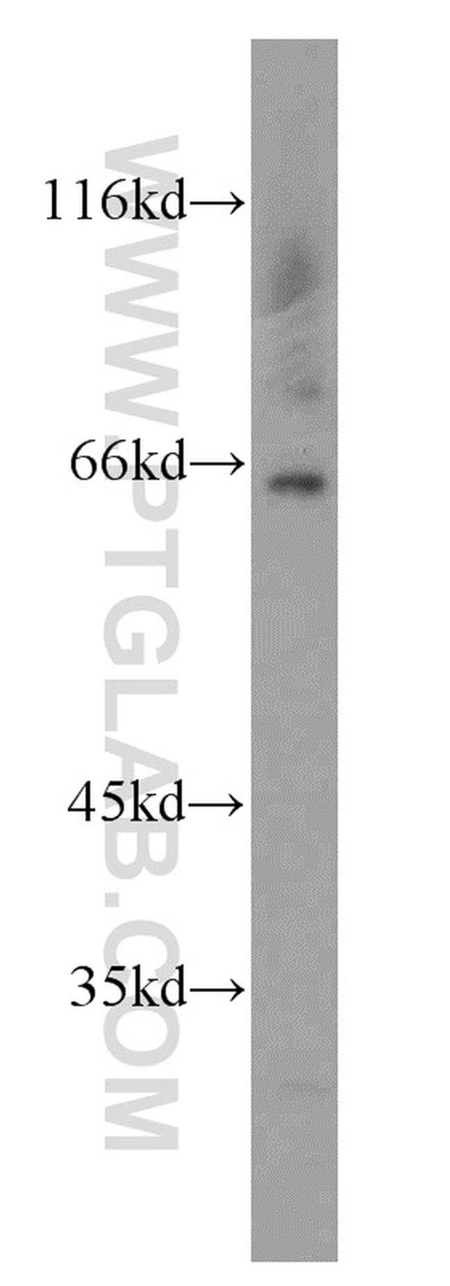 HEXB Antibody in Western Blot (WB)