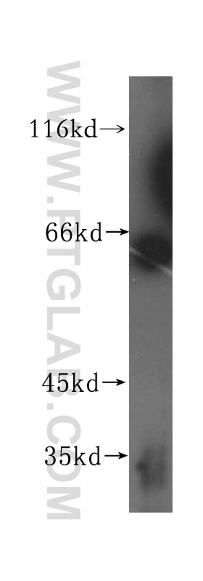 HEXB Antibody in Western Blot (WB)