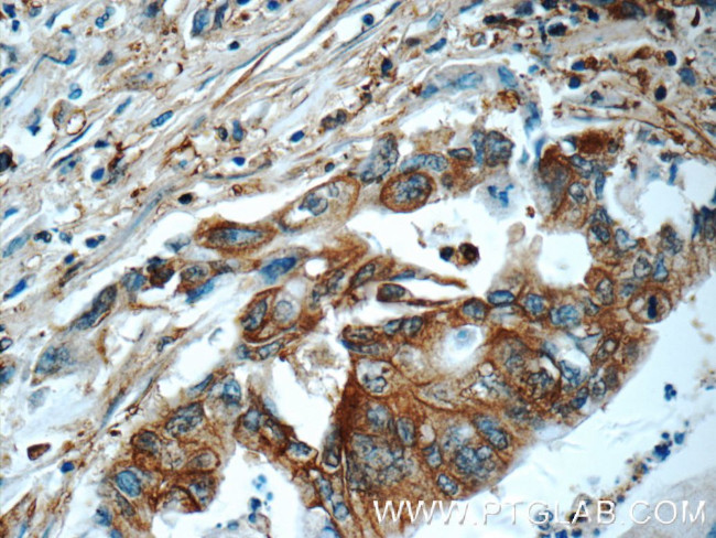 CAP1 Antibody in Immunohistochemistry (Paraffin) (IHC (P))