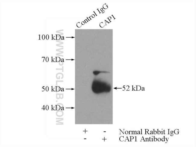 CAP1 Antibody in Immunoprecipitation (IP)