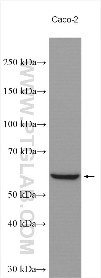 CAP1 Antibody in Western Blot (WB)