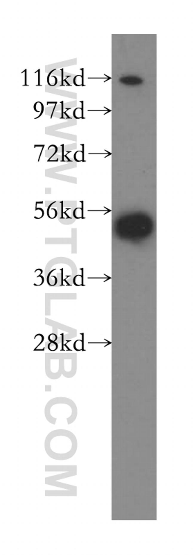 CAP1 Antibody in Western Blot (WB)