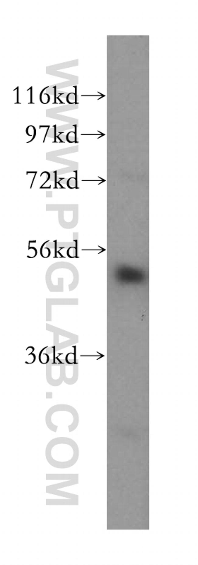 CAP1 Antibody in Western Blot (WB)