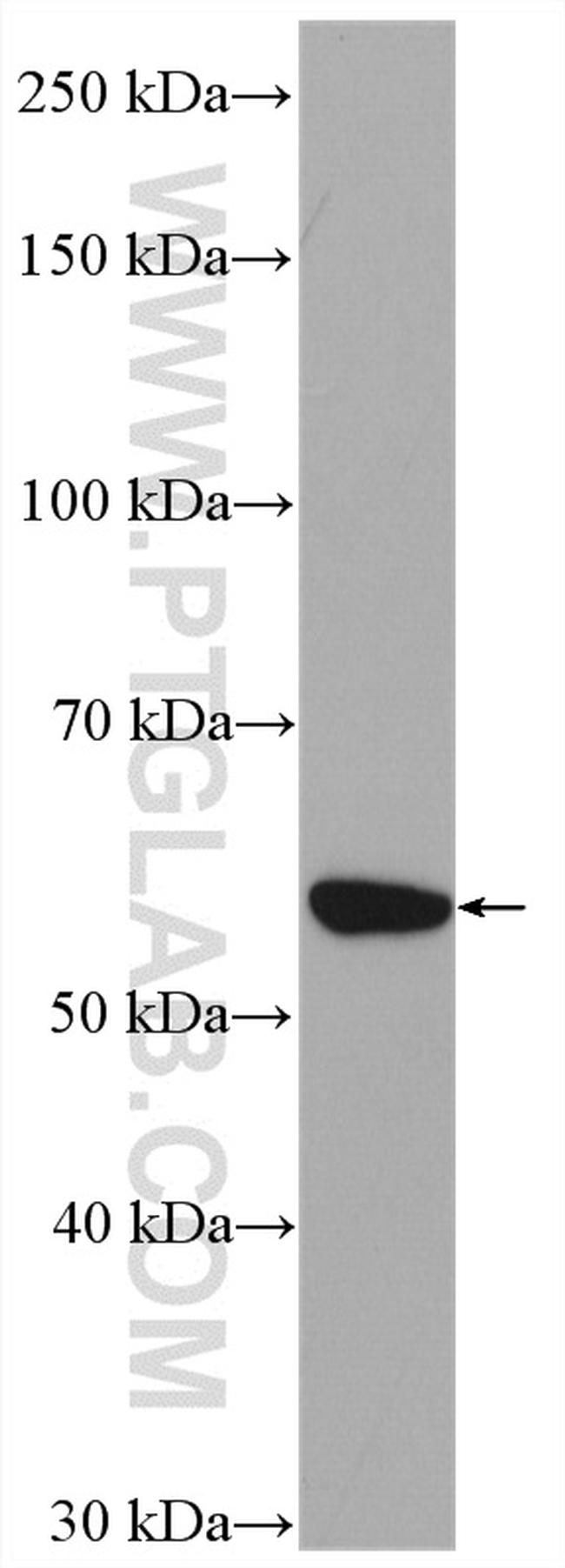 NUP54 Antibody in Western Blot (WB)