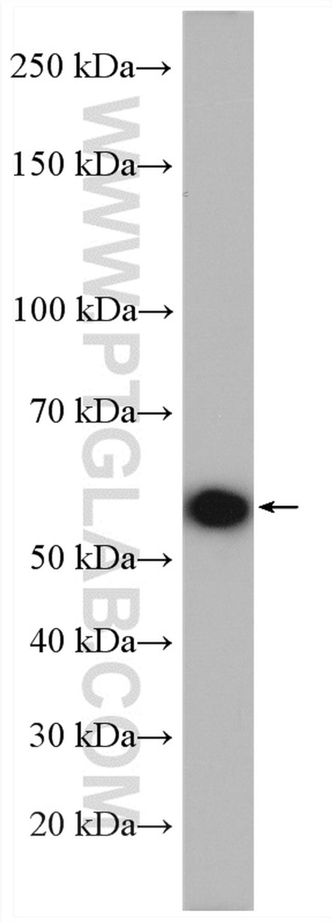 NUP54 Antibody in Western Blot (WB)