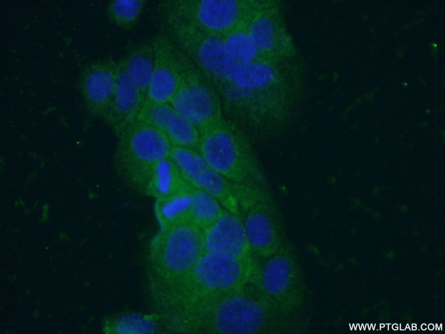 VIP Antibody in Immunocytochemistry (ICC/IF)