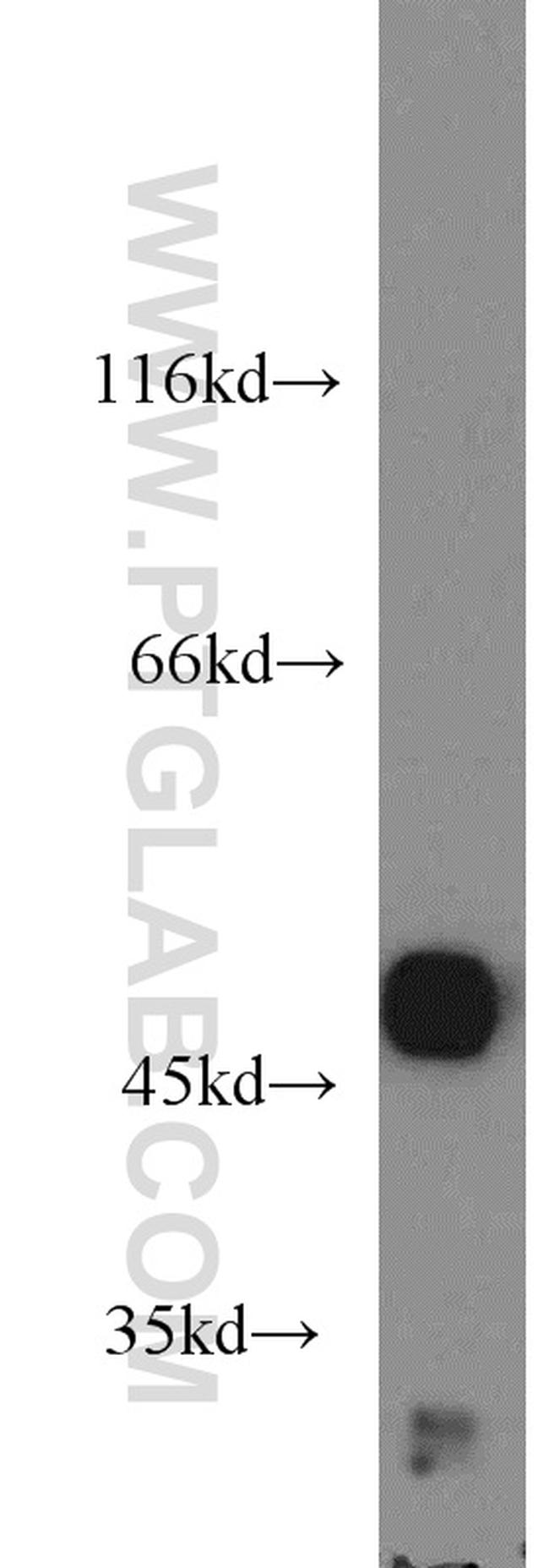 Carboxypeptidase A3 Antibody in Western Blot (WB)