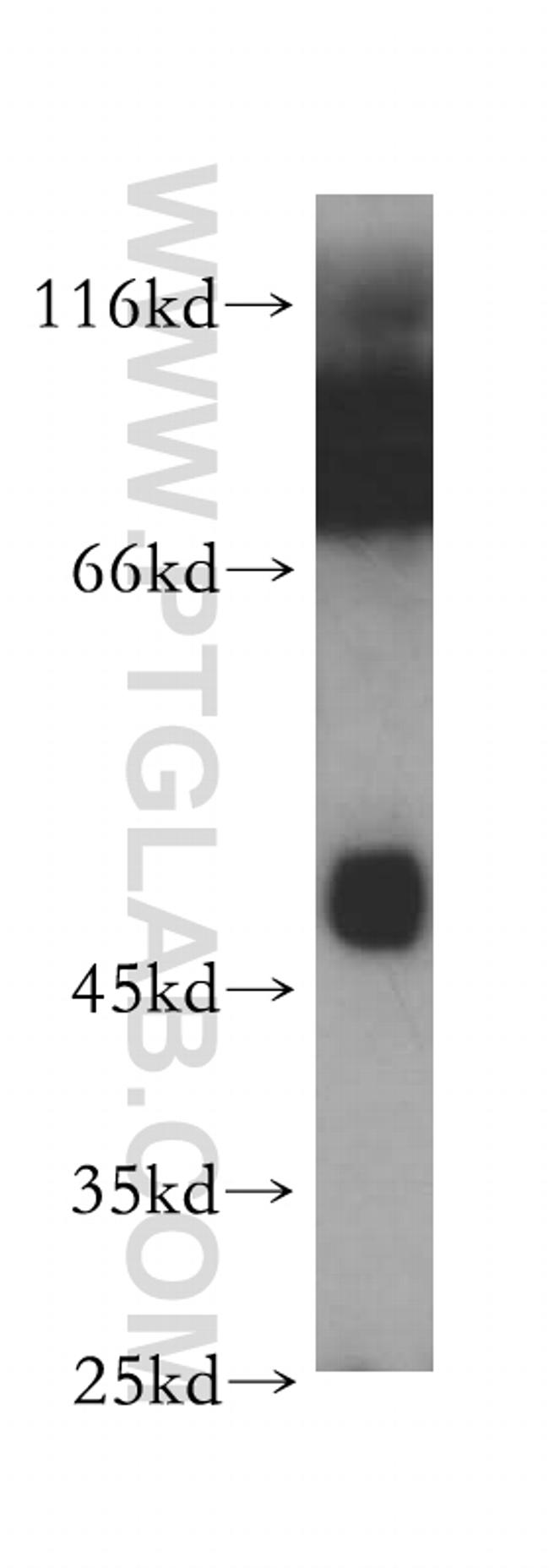 Carboxypeptidase A3 Antibody in Western Blot (WB)