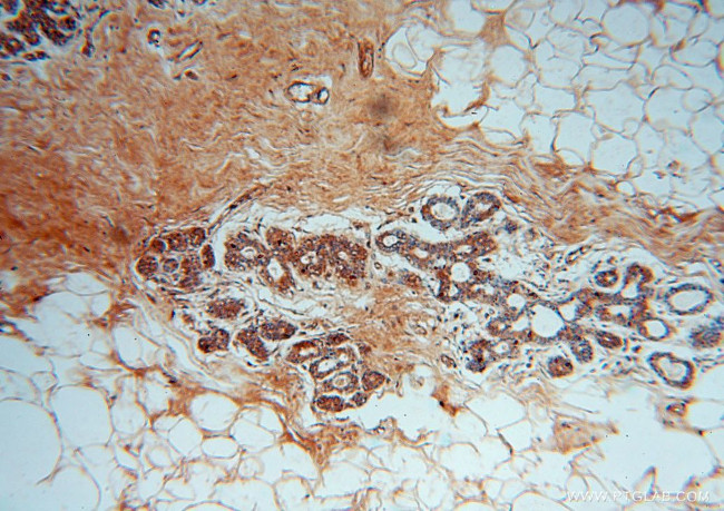 MRPL13 Antibody in Immunohistochemistry (Paraffin) (IHC (P))