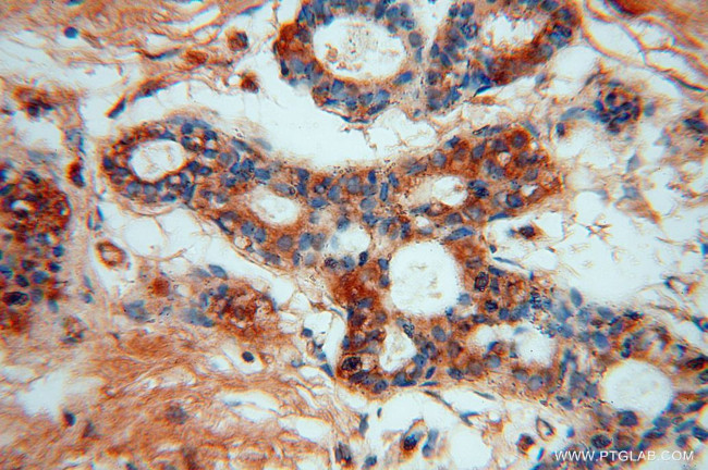 MRPL13 Antibody in Immunohistochemistry (Paraffin) (IHC (P))