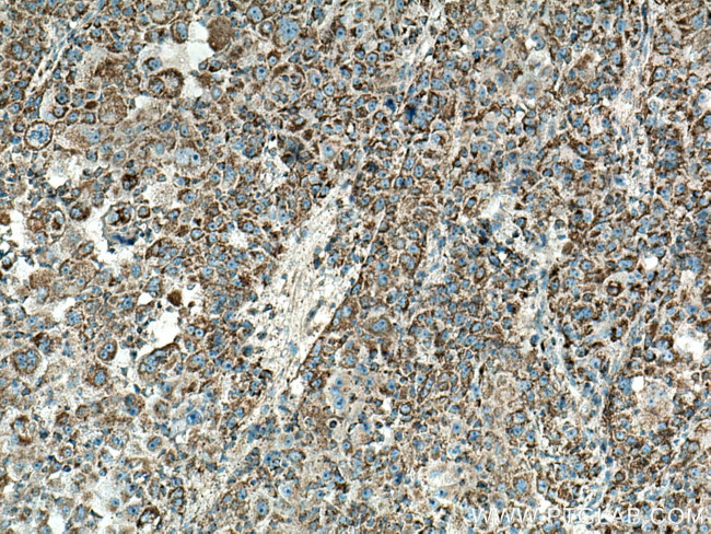 MRPL13 Antibody in Immunohistochemistry (Paraffin) (IHC (P))