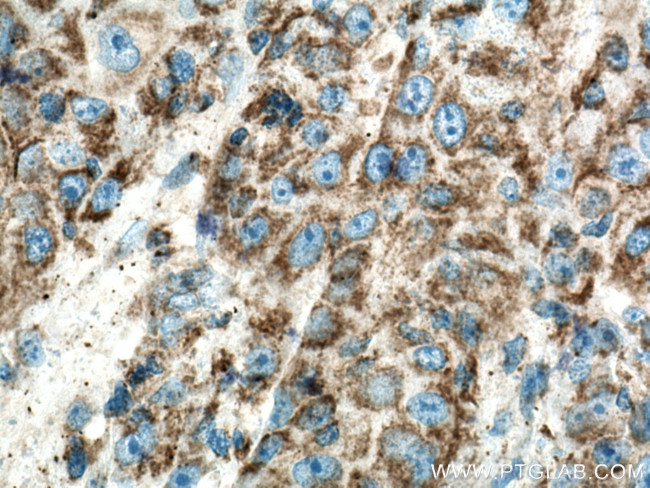 MRPL13 Antibody in Immunohistochemistry (Paraffin) (IHC (P))