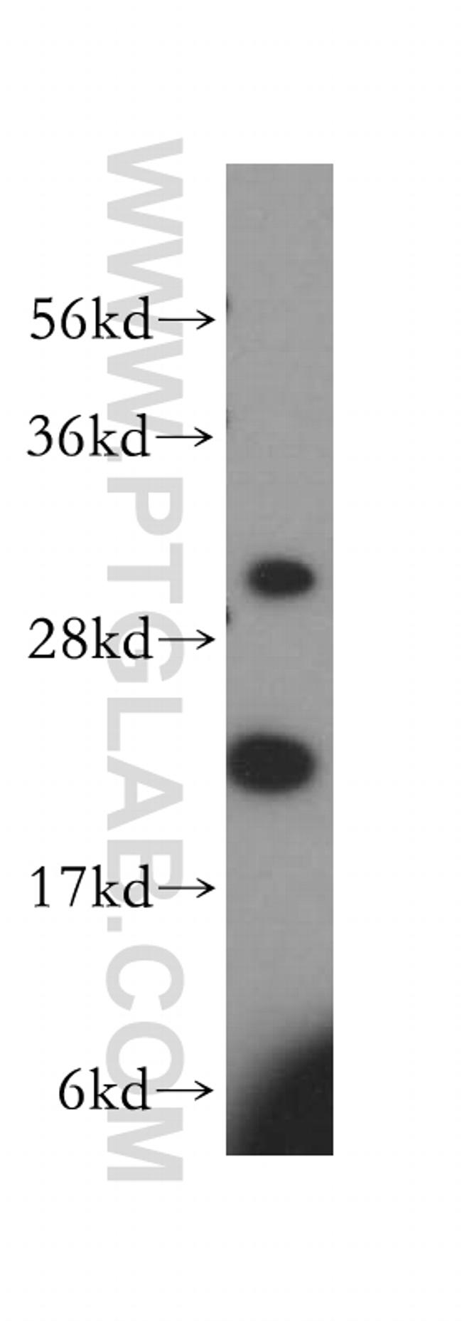 MRPL13 Antibody in Western Blot (WB)