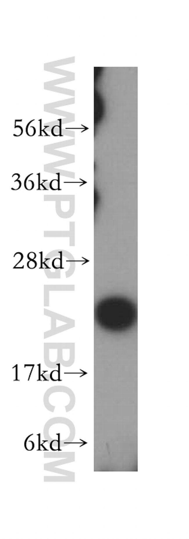 MRPL13 Antibody in Western Blot (WB)