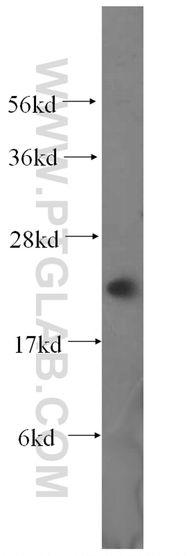 MRPL13 Antibody in Western Blot (WB)