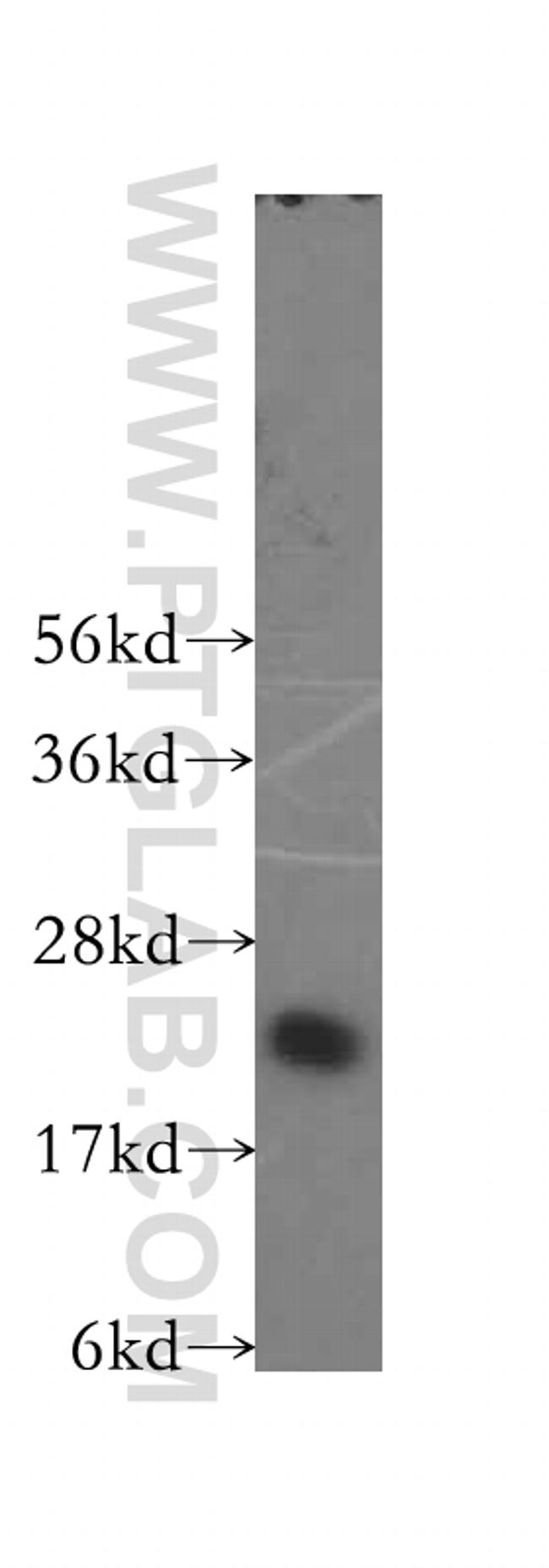 MRPL13 Antibody in Western Blot (WB)