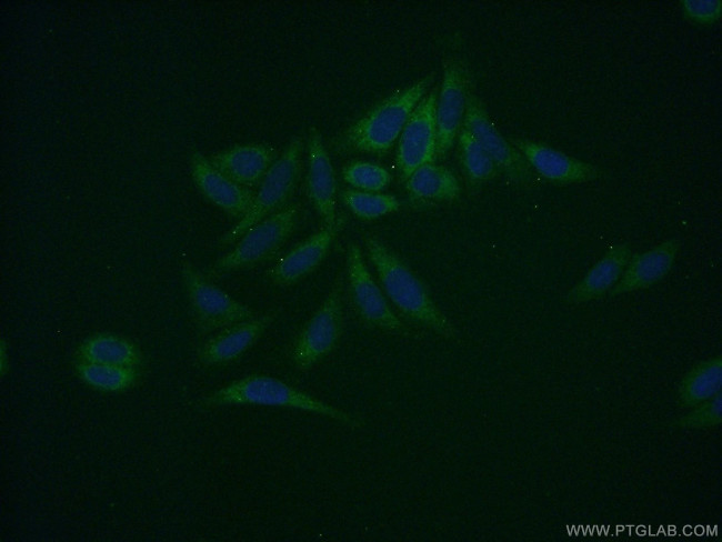 SDSL Antibody in Immunocytochemistry (ICC/IF)