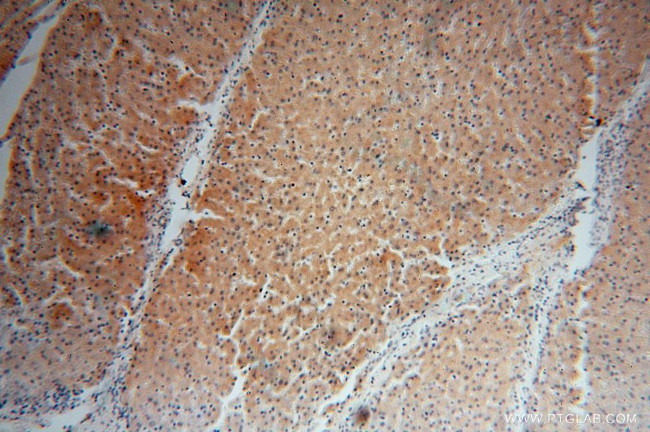 SDSL Antibody in Immunohistochemistry (Paraffin) (IHC (P))