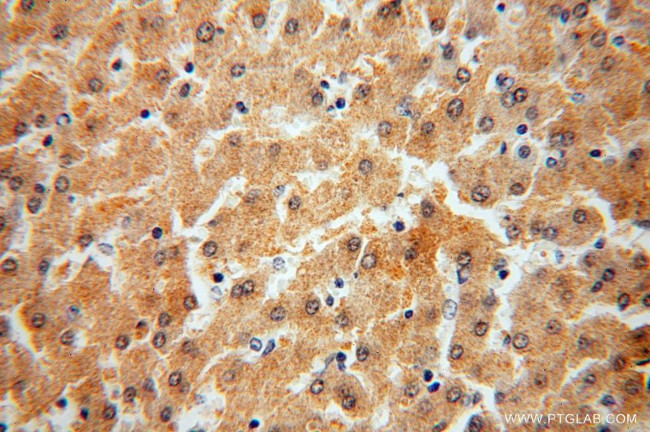 SDSL Antibody in Immunohistochemistry (Paraffin) (IHC (P))