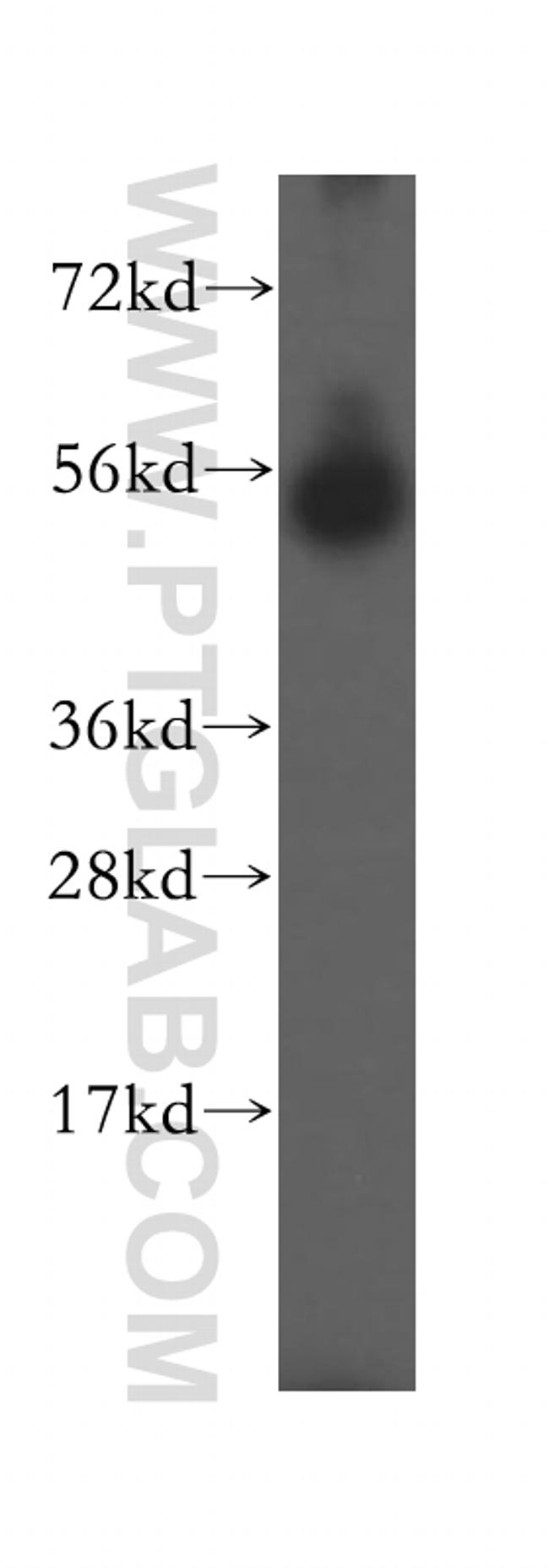 SDSL Antibody in Western Blot (WB)