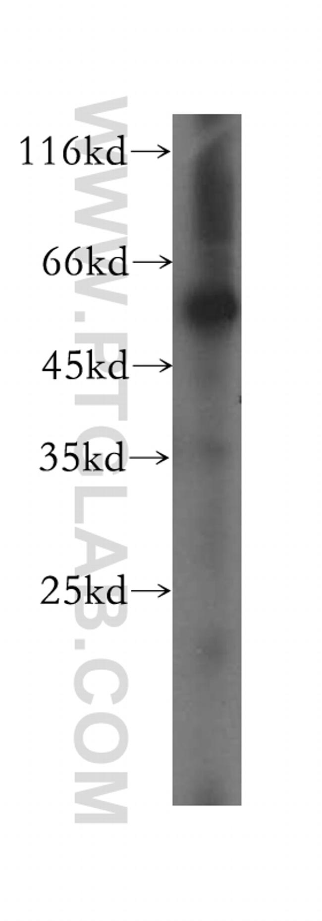 SDSL Antibody in Western Blot (WB)