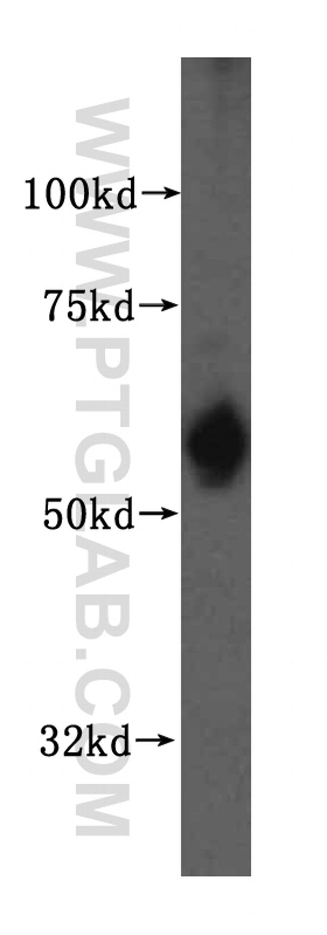 SDSL Antibody in Western Blot (WB)