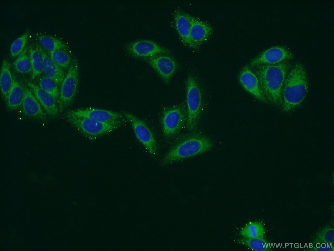 ATP13A1 Antibody in Immunocytochemistry (ICC/IF)