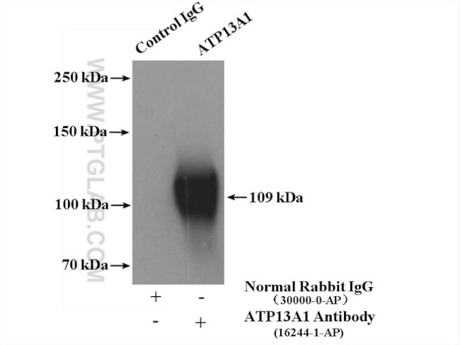 ATP13A1 Antibody in Immunoprecipitation (IP)