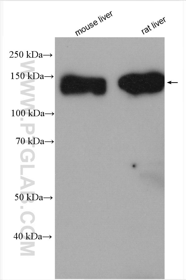 ATP13A1 Antibody in Western Blot (WB)