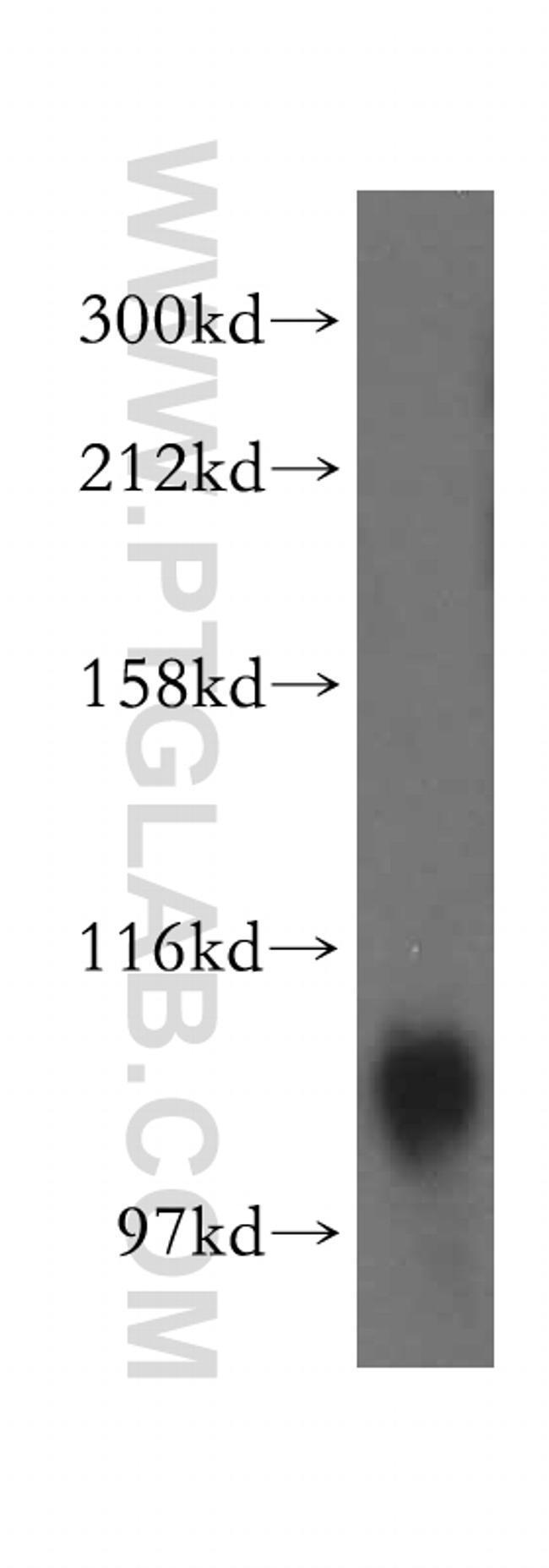 ATP13A1 Antibody in Western Blot (WB)