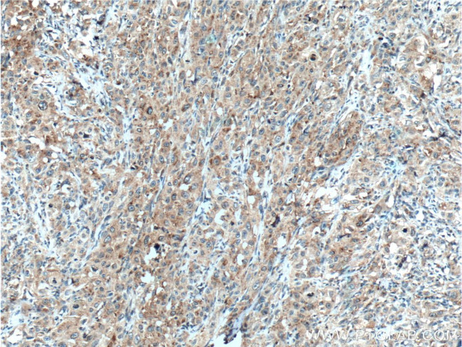 SAT2 Antibody in Immunohistochemistry (Paraffin) (IHC (P))