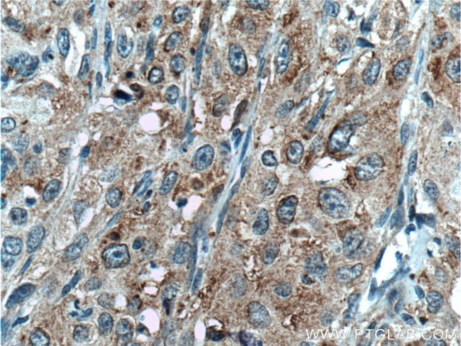 SAT2 Antibody in Immunohistochemistry (Paraffin) (IHC (P))